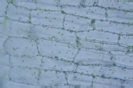 Chloroplastes d'une feuille de mâche