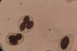 Truffe - Identification au microscope de spores de Tuber melanosporum